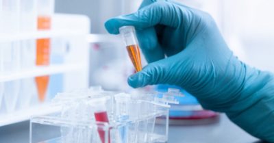 Tây Ban Nha ngưng sử dụng bộ kit xét nghiệm nhanh Covid-19 của Trung Quốc