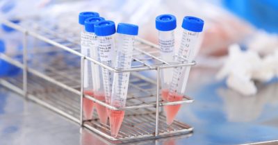 Bắt giám đốc TT Kiểm soát bệnh tật Hà Nội vì nâng giá máy xét nghiệm Covid-19