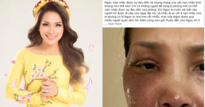 Văn hoá – Giải trí ngày 24/5: Ca sĩ Hồng Ngọc chia sẻ gương mặt bị bỏng nặng