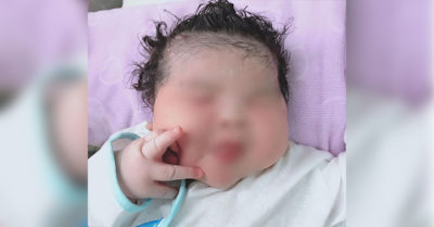 Sản phụ 100 kg sinh con nặng hơn 6 kg