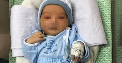 Bé sơ sinh bị bỏ rơi ở hố ga được chẩn đoán nhiễm trùng nặng