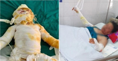 Chập điện cháy điều hòa: Chồng chết, vợ và 2 con nhỏ nguy kịch