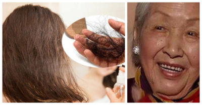 Tin Sức khỏe ngày 5/6 : Rụng gần hết tóc vì dùng thuốc xịt tóc; Thói quen giúp cụ bà 115 tuổi sống thọ và đẹp lão dù bị ung thư ruột