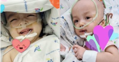 Trúc Nhi – Diệu Nhi đã cai máy thở, biết giỡn cười khi ba mẹ tới thăm