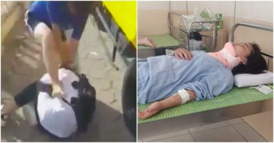 Nữ sinh lớp 8 bị bạn túm tóc, đạp vào đầu dẫn đến chấn thương cột sống