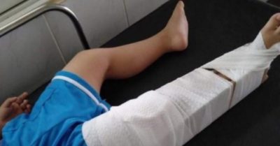 Tạm đình chỉ giáo viên mầm non làm bé 3 tuổi gãy xương đùi trong lớp