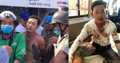 Ôm can xăng vào ngân hàng thực thi ‘khổ nhục kế’, tên cướp bị bỏng khắp người