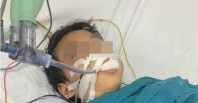 Ăn nhầm “kẹo” diệt chuột, bé lớp 1 lọc máu và chạy thận