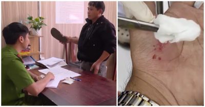 Bị yêu cầu đo nồng độ cồn, tài xế cắn CSGT gây thương tích