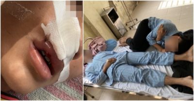 Gãy răng, liên tục đau đầu vì bị bạn giải quyết xích mích bằng ghế, thắt lưng tại trường