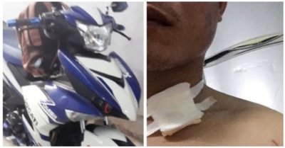 Tài xế GrabBike lên mạng kêu cứu vì bị cướp đâm ở cổ rồi lấy mất xe máy