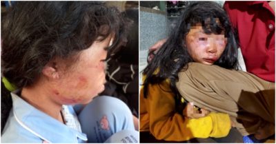 Lời kể của nữ sinh lớp 6 bị người đàn ông đánh bất tỉnh trong rừng cao su