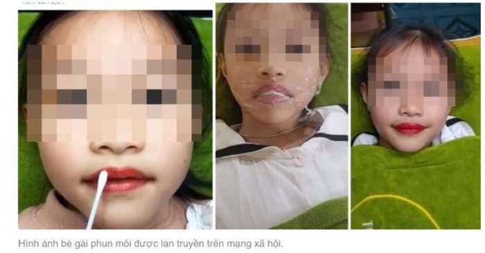 Một chủ trung tâm thẩm mỹ phun xăm môi cho con gái 5 tuổi (ảnh từ mạng xã hội).