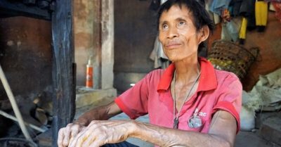 “Người rừng” Hồ Văn Lang nhọc nhằn sống cùng bệnh ung thư