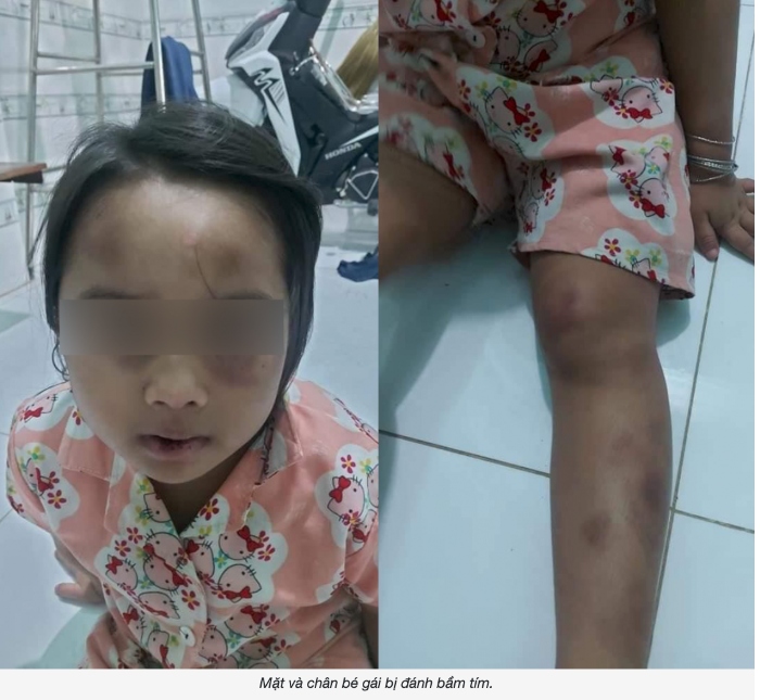 Cập nhật tối 17/7: Cả nước ghi nhận gần 4.000 ca Covid-19 trong 24H; Biển Đông xuất hiện vùng áp thấp