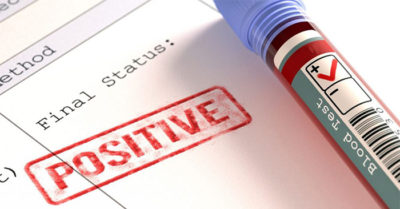 Dương tính với ma túy là gì? Các phương pháp xét nghiệm ma túy