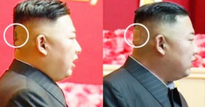 Ông Kim Jong Un bất ngờ xuất hiện với đầu bị băng bó