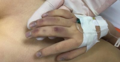 Công an 2 quận ở Hà Nội vào cuộc điều tra vụ bé gái 6 tuổi tử vong nghi do bị bạo hành