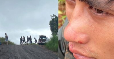 Người của công ty điện gió thuê 14 người đi ‘hỗ trợ’ thoả thuận đền bù, không được ngang nhiên đánh người dân