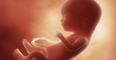 Hy hữu thai nhi 7 tháng nằm trong bụng cụ bà suốt 35 năm