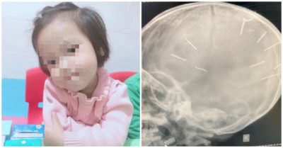 Vụ bé 3 tuổi bị đinh ghim vào đầu: Nghi phạm chính là người tình của mẹ