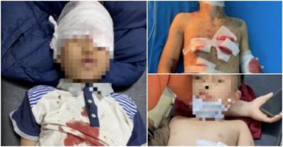 Đốt pháo mua trên mạng, 4 bé trai bị thương nặng