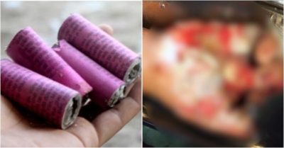 Tự chế pháo để chơi, nhiều bé trai đón Tết đau đớn trong bệnh viện