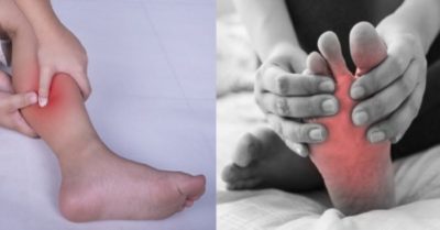 Một số cách điều trị và phòng ngừa chuột rút ở chân hiệu quả