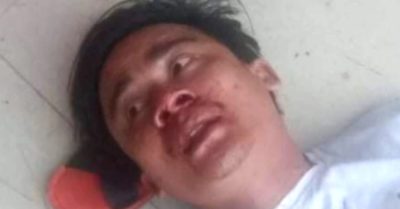 Lên công ty nhận lương, công nhân bị giám đốc đánh nhập viện