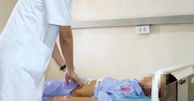 Cảnh báo tình trạng trẻ em mắc Covid-19 bị thủng dạ dày