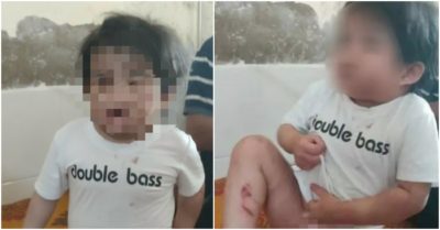 Hà Tĩnh: Bé gái 4 tuổi nhập viện với nhiều vết thương, nghi bị bạo hành