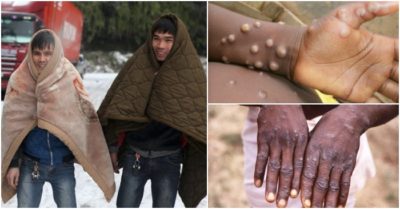 Cập nhật tối 8/5: Miền Bắc đón không khí lạnh hiếm gặp trong 40 năm; Anh ghi nhận trường hợp mắc bệnh đậu mùa khỉ hiếm gặp