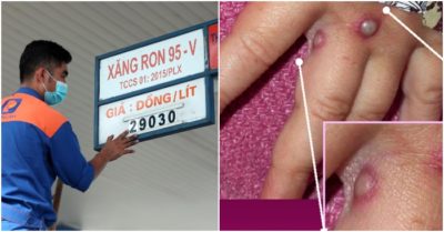 Cập nhật tối 21/5: Giá xăng có thể tăng lần thứ 5 liên tiếp; Virus đậu mùa khỉ sẽ nối tiếp đại dịch Covid-19?