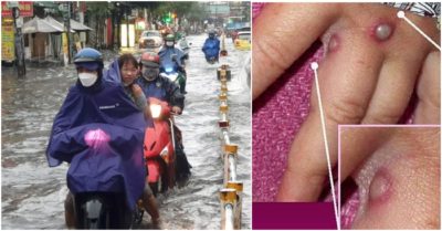 Cập nhật tối 2/6: Sấm sét ầm trời, TP. HCM mưa xối xả; Campuchia phát hiện 6 ca nghi mắc đậu mùa khỉ