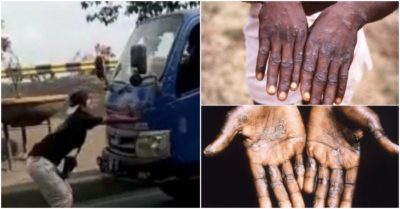 Cập nhật tối 9/6: Chặn đầu xe tải theo ‘trend’ TikTok, thanh niên mất mạng; Đậu mùa khỉ có thể lây qua không khí như nCoV